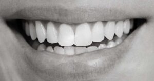 Biblical Meaning of Dreaming of Teeth